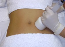 Endermoterapia