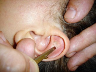 auriculo auriculo
