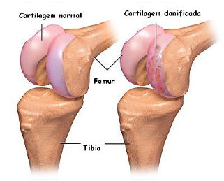 silicio - articulacao