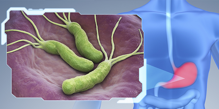 H pylori no estomago