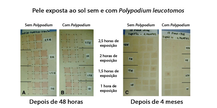 Pele exposta ao sol sem e com Polypodium leucotomos