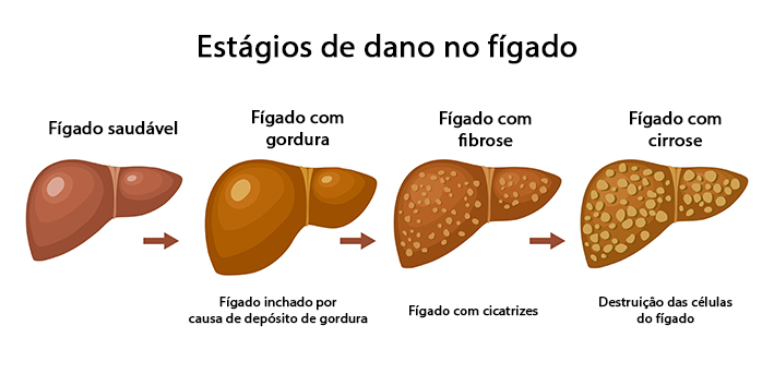 Estagios de dano no figado