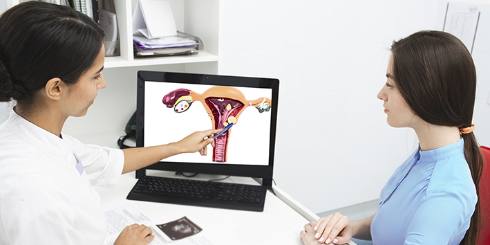 Medica ginecologista mioma uterino