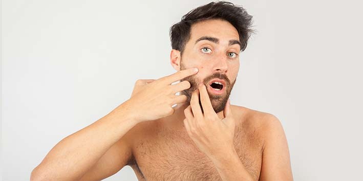 Sabal para espinhas acne Sabal para espinhas acne