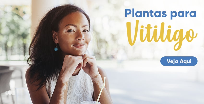 Vitiligo: vamos aprender sobre essa condi��o? | Farm�cia de Manipula��o - Oficina de Ervas: C�psulas, Tinturas, Cosm�ticos e Ess�ncias.