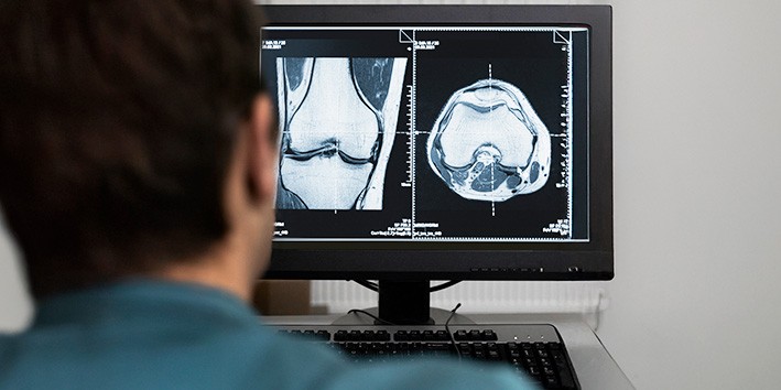 Osteoporose causa dor sintomas diagnostico