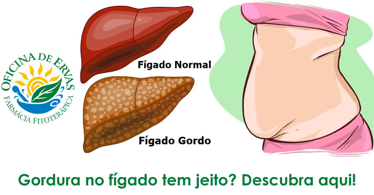 Gordura no fígado tem jeito? Descubra aqui!